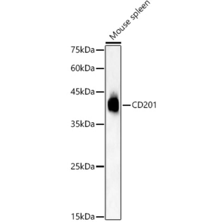 Western Blot - Anti-EPCR/CD201 Antibody (A309879) - Antibodies.com