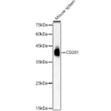 Western Blot - Anti-EPCR/CD201 Antibody (A309879) - Antibodies.com