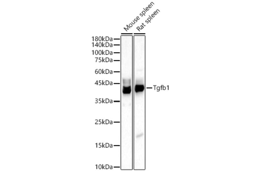 Western Blot - Anti-TGF beta 1 Antibody (A309881) - Antibodies.com