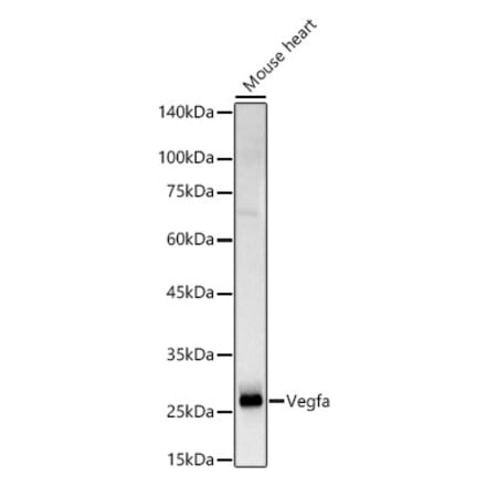 Western Blot - Anti-VEGFA Antibody (A309882) - Antibodies.com