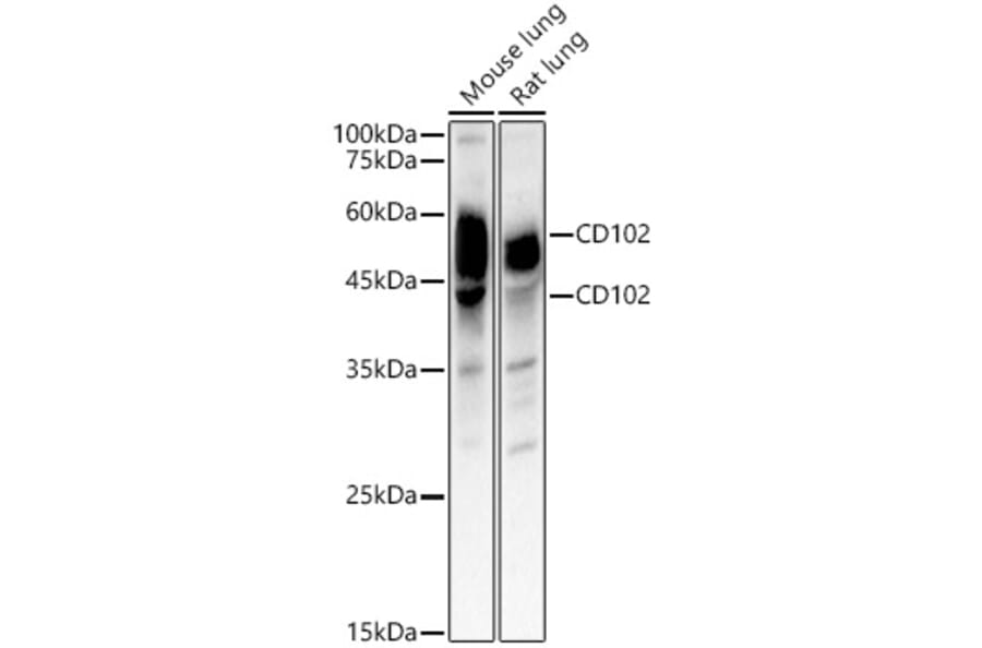 Western Blot - Anti-ICAM2 Antibody (A309884) - Antibodies.com