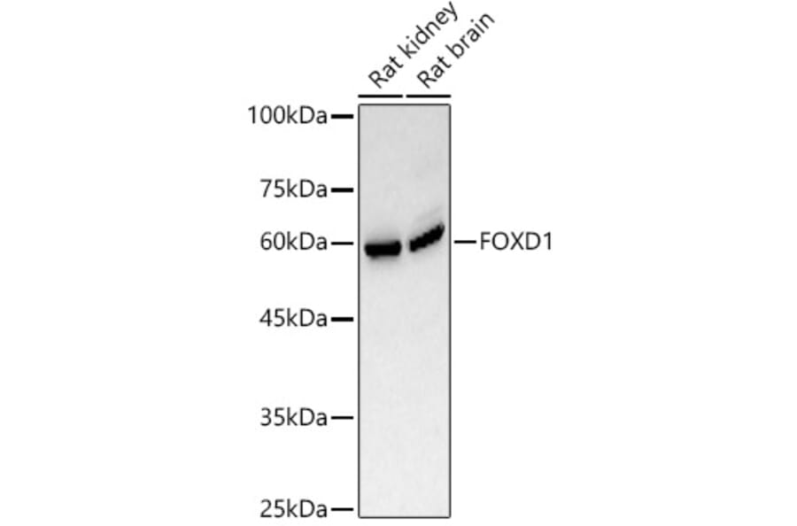 Western Blot - Anti-FOXD1/BF-2 Antibody (A309886) - Antibodies.com