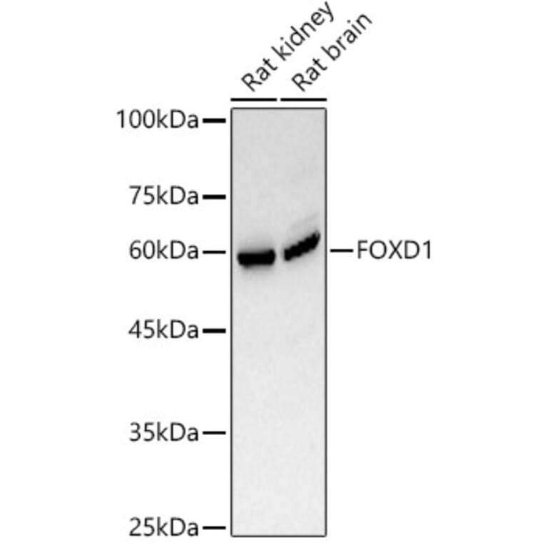 Western Blot - Anti-FOXD1/BF-2 Antibody (A309886) - Antibodies.com