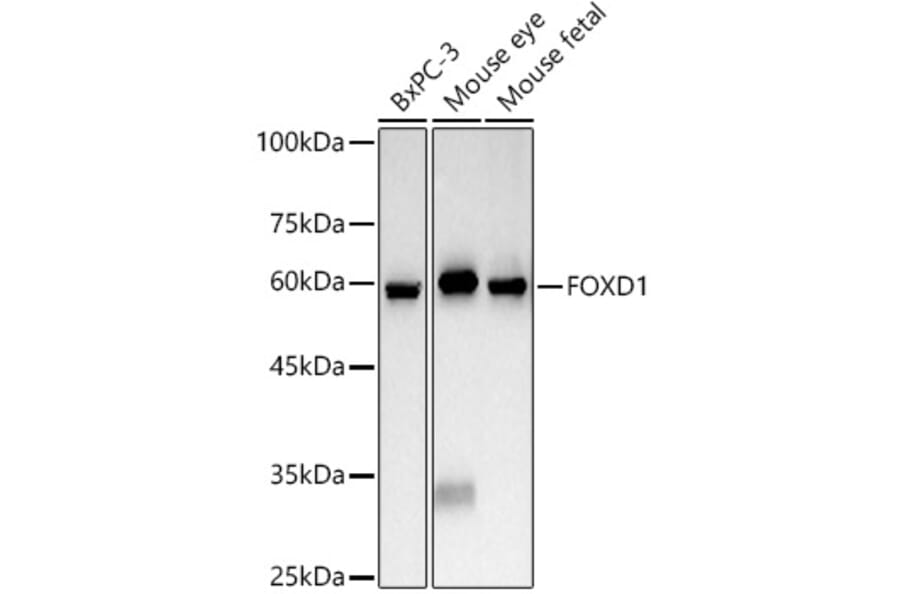 Western Blot - Anti-FOXD1/BF-2 Antibody (A309886) - Antibodies.com
