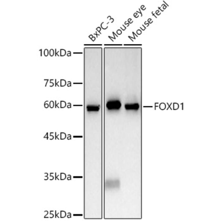 Western Blot - Anti-FOXD1/BF-2 Antibody (A309886) - Antibodies.com