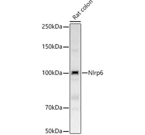 Western Blot - Anti-Nlrp6 Antibody (A309887) - Antibodies.com