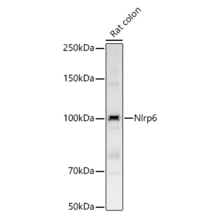 Western Blot - Anti-Nlrp6 Antibody (A309887) - Antibodies.com