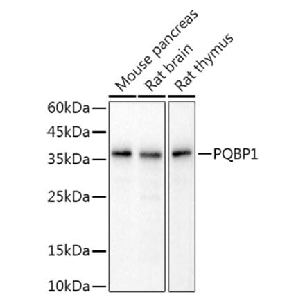 Western Blot - Anti-PQBP1 Antibody [ARC2697] (A309889) - Antibodies.com