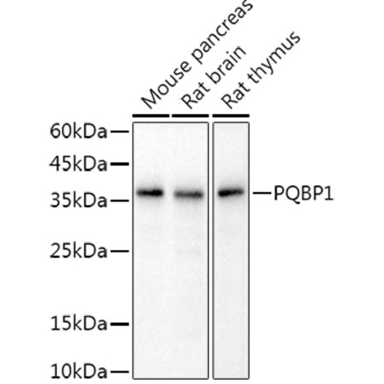 Western Blot - Anti-PQBP1 Antibody [ARC2697] (A309889) - Antibodies.com