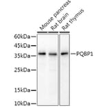Western Blot - Anti-PQBP1 Antibody [ARC2697] (A309889) - Antibodies.com