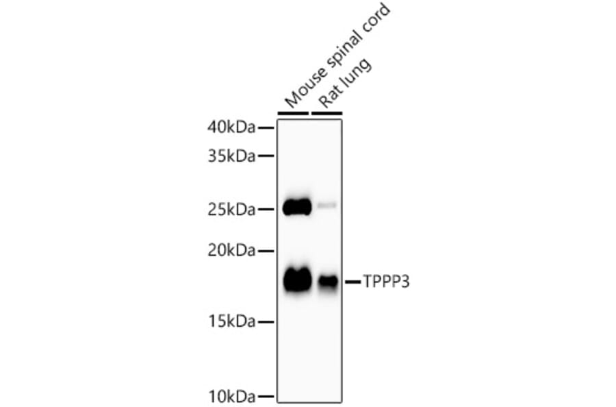 Western Blot - Anti-TPPP3 Antibody [ARC58837] (A309890) - Antibodies.com