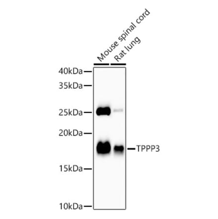 Western Blot - Anti-TPPP3 Antibody [ARC58837] (A309890) - Antibodies.com