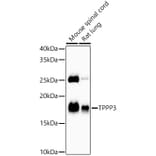 Western Blot - Anti-TPPP3 Antibody [ARC58837] (A309890) - Antibodies.com