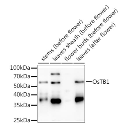 Western Blot - Anti-TB1 Antibody (A309900) - Antibodies.com