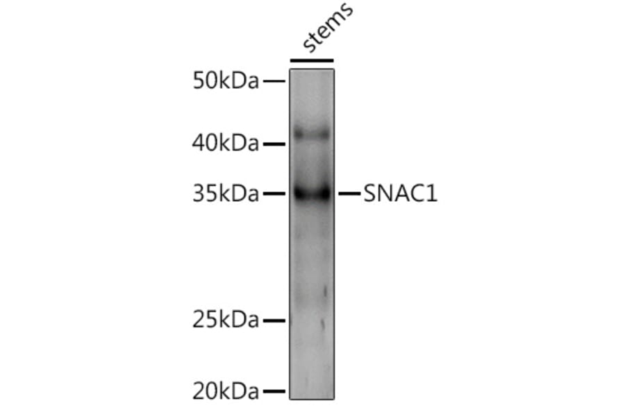 Western Blot - Anti-NAC002 Antibody (A309903) - Antibodies.com