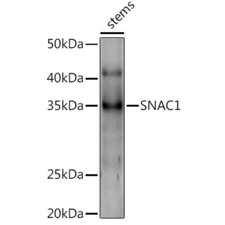 Western Blot - Anti-NAC002 Antibody (A309903) - Antibodies.com