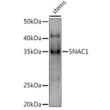 Western Blot - Anti-NAC002 Antibody (A309903) - Antibodies.com