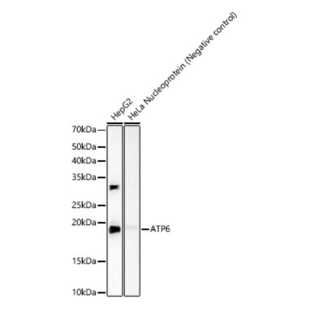Western Blot - Anti-Mtatp6 Antibody [ARC59849] (A309915) - Antibodies.com