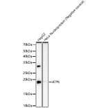 Western Blot - Anti-Mtatp6 Antibody [ARC59849] (A309915) - Antibodies.com