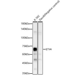 Western Blot - Anti-Pea3 Antibody [ARC58618] (A309916) - Antibodies.com