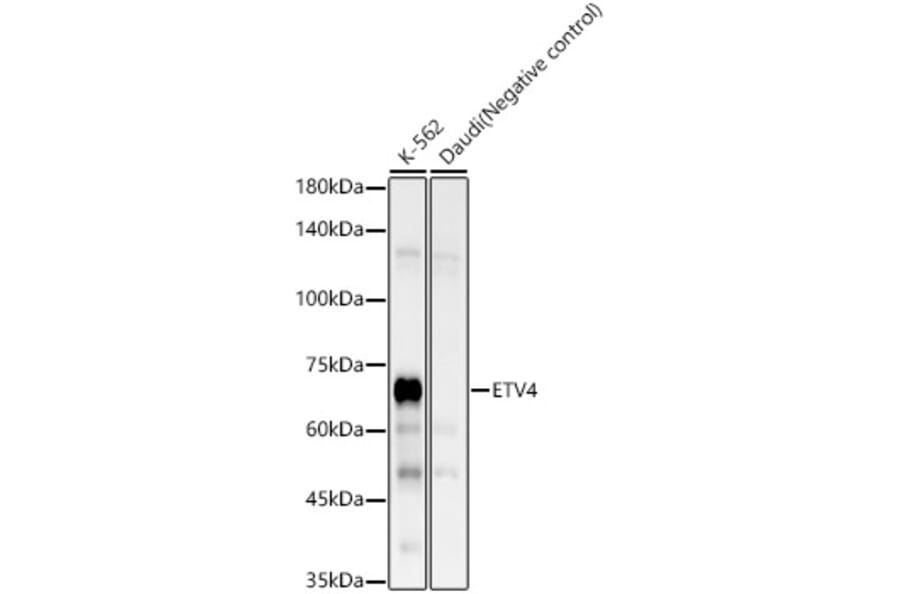 Western Blot - Anti-Pea3 Antibody [ARC58618] (A309916) - Antibodies.com