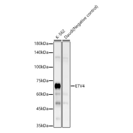 Western Blot - Anti-Pea3 Antibody [ARC58618] (A309916) - Antibodies.com