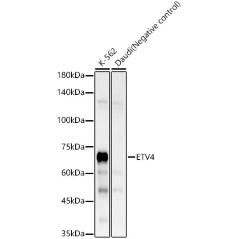 Western Blot - Anti-Pea3 Antibody [ARC58618] (A309916) - Antibodies.com