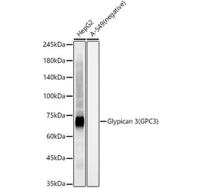 Western Blot - Anti-Glypican 3 Antibody (A309918) - Antibodies.com