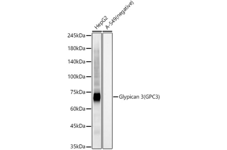 Western Blot - Anti-Glypican 3 Antibody [ARC56906] (A309918) - Antibodies.com