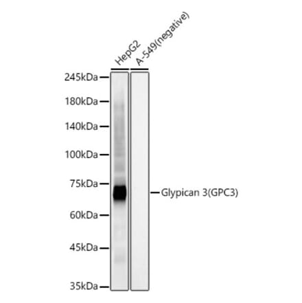 Western Blot - Anti-Glypican 3 Antibody [ARC56906] (A309918) - Antibodies.com