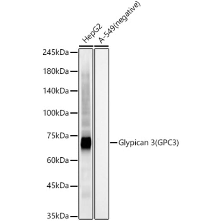 Western Blot - Anti-Glypican 3 Antibody [ARC56906] (A309918) - Antibodies.com