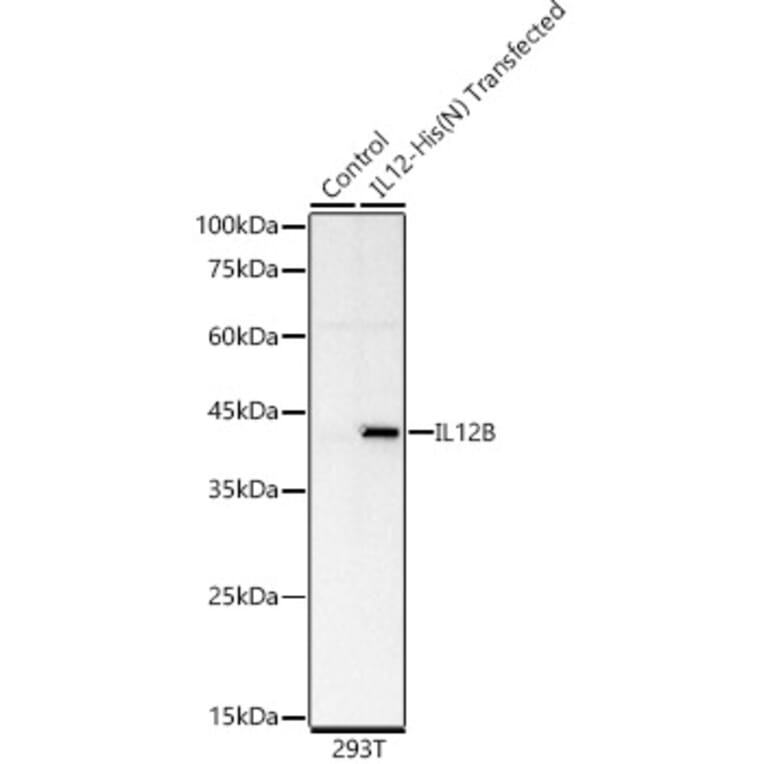 Western Blot - Anti-IL-12B Antibody [ARC60328] (A309920) - Antibodies.com