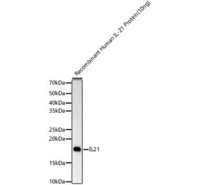 Western Blot - Anti-IL-21 Antibody [ARC60383] (A309923) - Antibodies.com