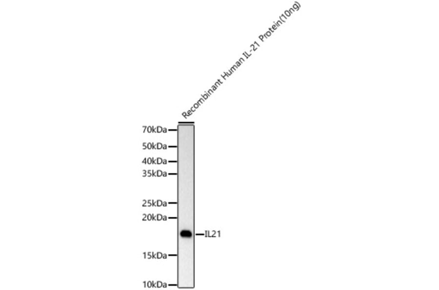 Western Blot - Anti-IL-21 Antibody [ARC60383] (A309923) - Antibodies.com