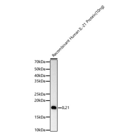 Western Blot - Anti-IL-21 Antibody [ARC60383] (A309923) - Antibodies.com