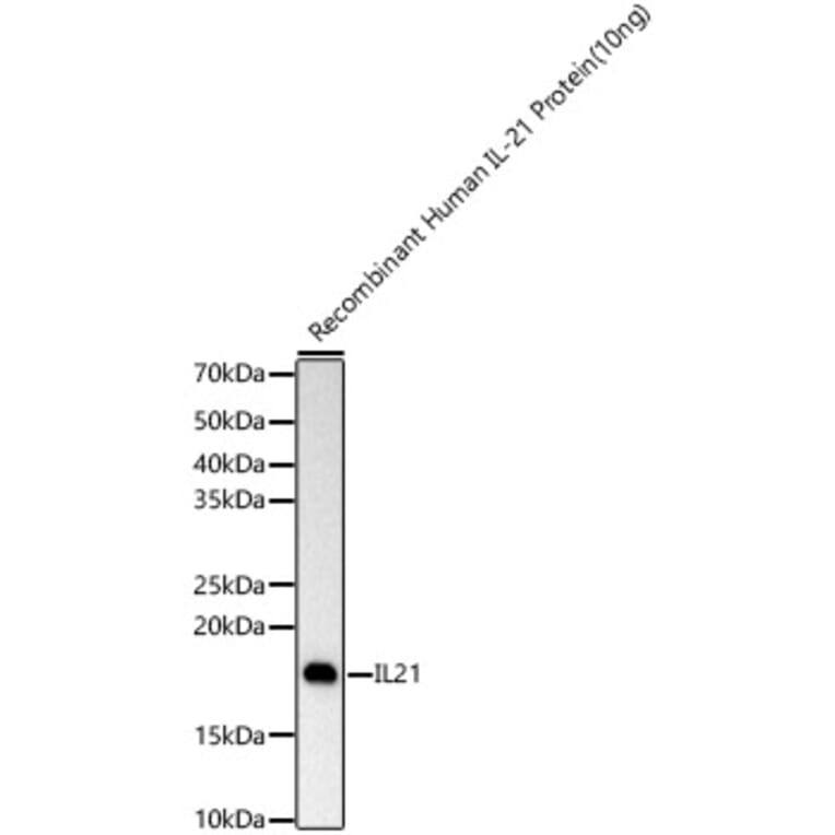 Western Blot - Anti-IL-21 Antibody [ARC60383] (A309923) - Antibodies.com