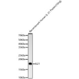 Western Blot - Anti-IL-21 Antibody [ARC60383] (A309923) - Antibodies.com