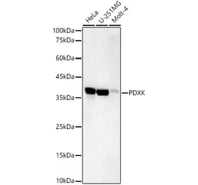 Western Blot - Anti-PDXK.1 Antibody [ARC59845] (A309927) - Antibodies.com