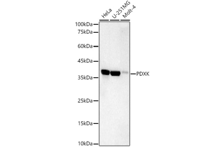 Western Blot - Anti-PDXK.1 Antibody [ARC59845] (A309927) - Antibodies.com