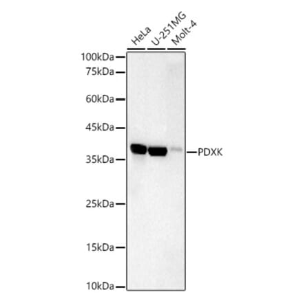 Western Blot - Anti-PDXK.1 Antibody [ARC59845] (A309927) - Antibodies.com