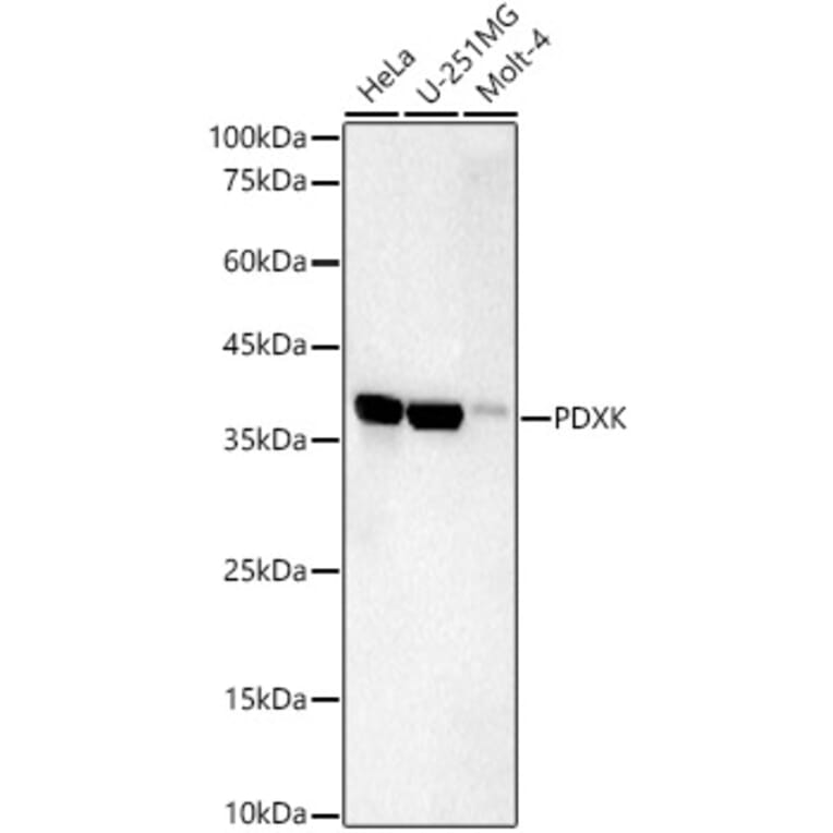 Western Blot - Anti-PDXK.1 Antibody [ARC59845] (A309927) - Antibodies.com