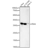 Western Blot - Anti-PDXK.1 Antibody [ARC59845] (A309927) - Antibodies.com