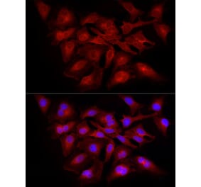 Immunofluorescence - Anti-NF-kB p65 Antibody (A309933) - Antibodies.com