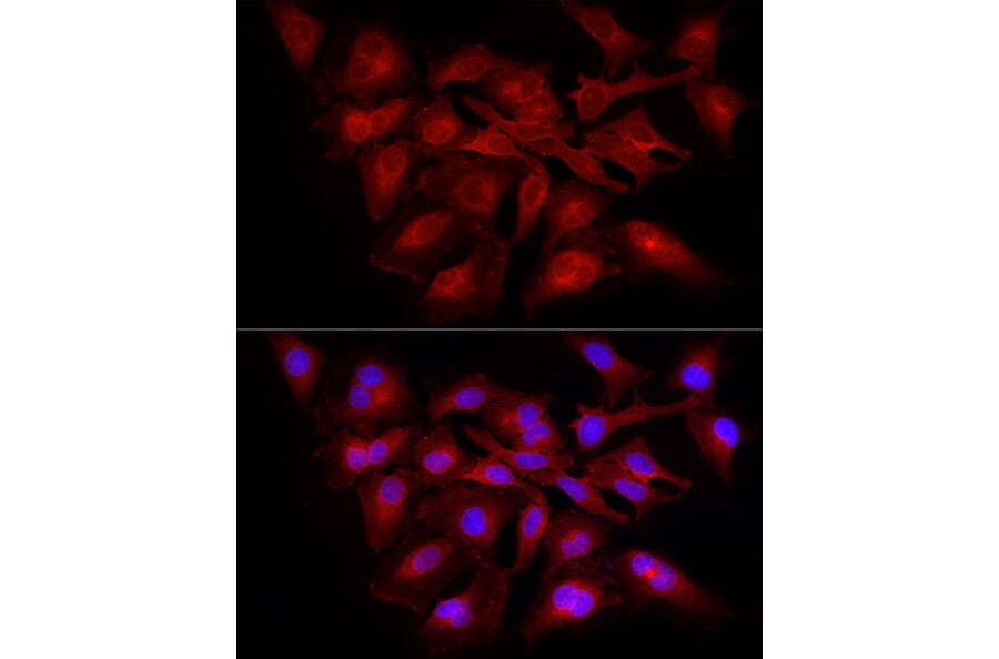 Immunofluorescence - Anti-NF-kB p65 Antibody (A309933) - Antibodies.com