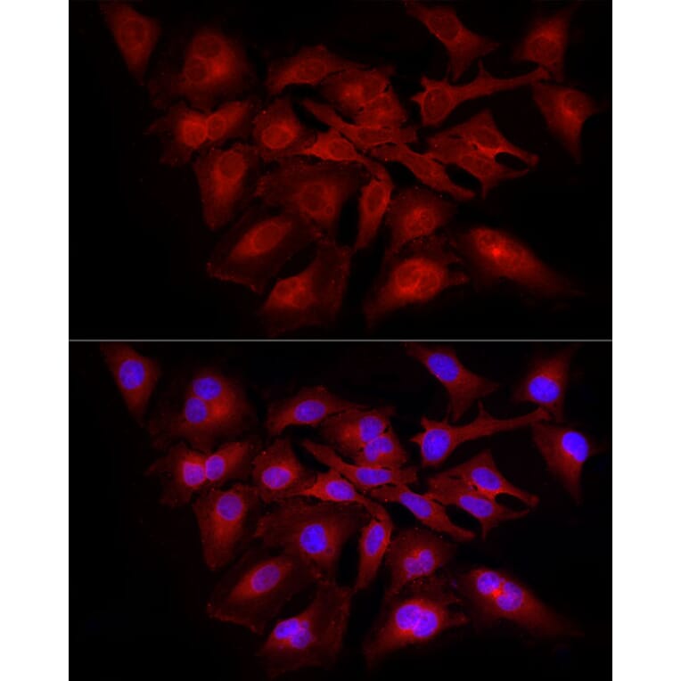 Immunofluorescence - Anti-NF-kB p65 Antibody (A309933) - Antibodies.com