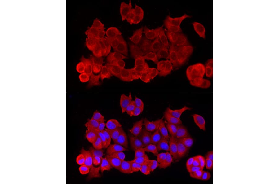 Immunofluorescence - Anti-NF-kB p65 Antibody (A309933) - Antibodies.com