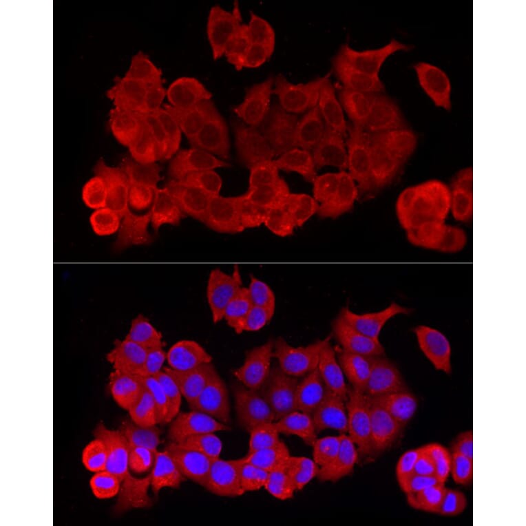 Immunofluorescence - Anti-NF-kB p65 Antibody (A309933) - Antibodies.com