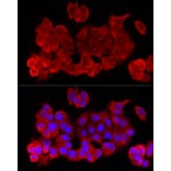Immunofluorescence - Anti-NF-kB p65 Antibody (A309933) - Antibodies.com