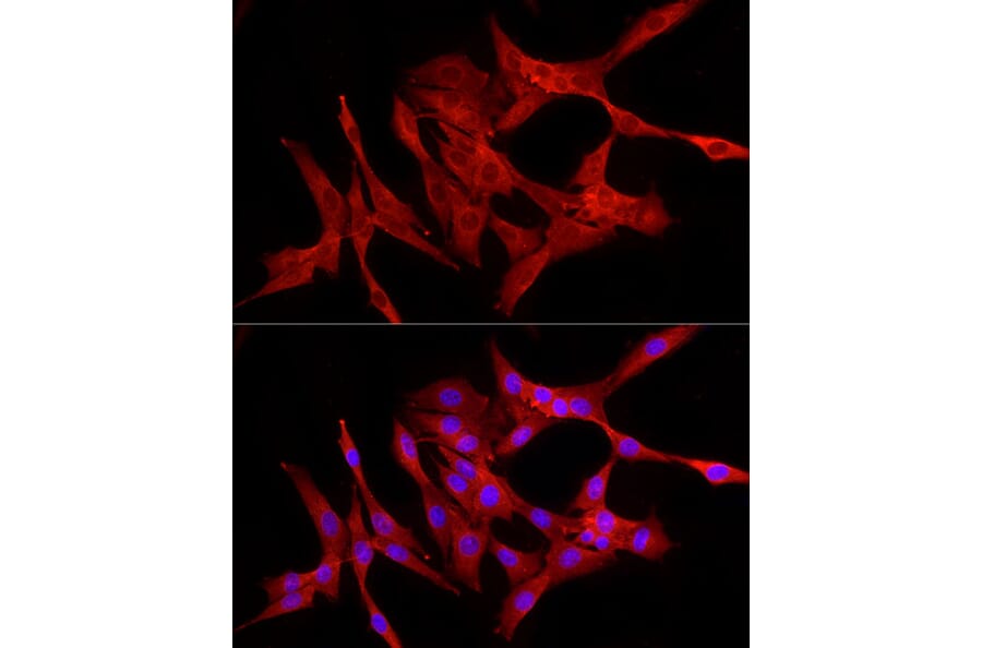 Immunofluorescence - Anti-NF-kB p65 Antibody (A309933) - Antibodies.com