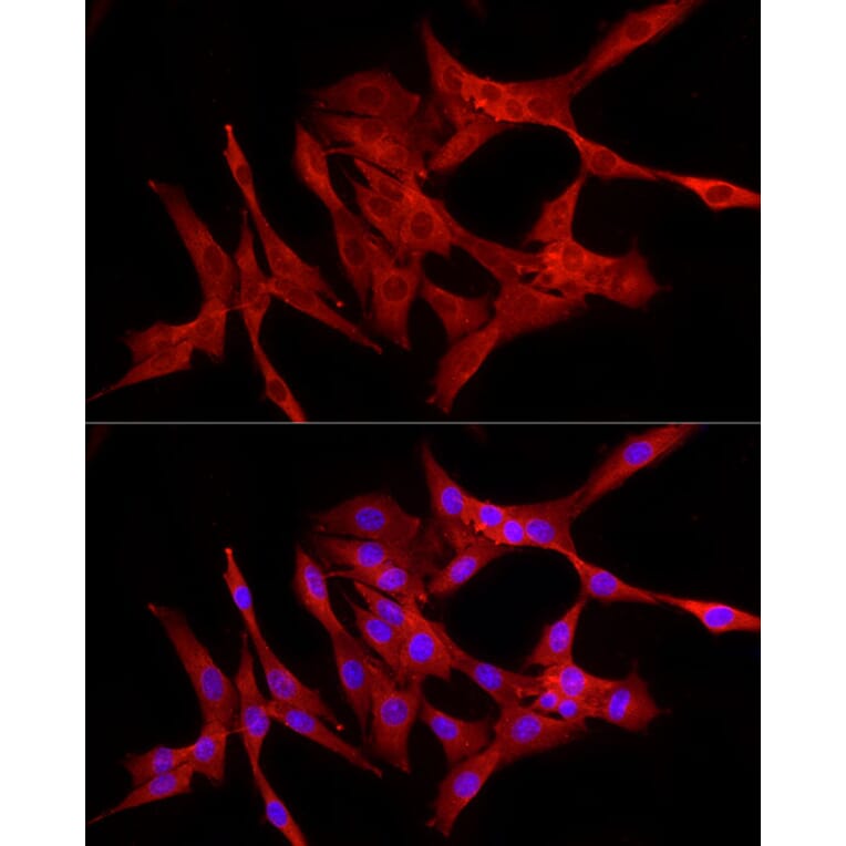 Immunofluorescence - Anti-NF-kB p65 Antibody (A309933) - Antibodies.com